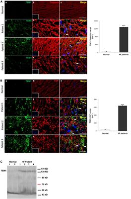 Soluble tumor endothelial marker 1 in heart failure with reduced ejection fraction: A pilot study